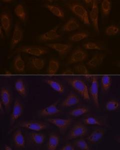 Immunofluorescence analysis of U-2 OS cells using Anti-Dcp1a Antibody [ARC1421] (A10006) at a dilution of 1:100 (40X lens). DAPI was used to stain the cell nuclei (blue)