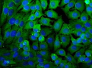 Anti-LDHA Rabbit Polyclonal Antibody