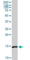 Anti-LGALS1 Rabbit Polyclonal Antibody