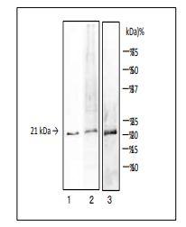 Anti-TDH toxin and TRH toxin antibody