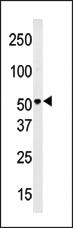 Anti-PMAT(Slc29a4) Rabbit Polyclonal Antibody