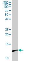 Anti-LGALS1 Rabbit Polyclonal Antibody