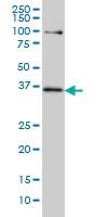 Anti-TCF19 Mouse Monoclonal Antibody [clone: 6D8]