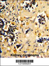 Anti-NADH Dehydrogenase Fe-S Protein 4 Rabbit Polyclonal Antibody (HRP (Horseradish Peroxidase))