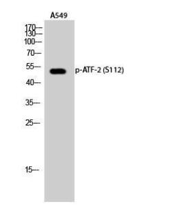 Western blot analysis of A549 cells using Anti-ATF2 (phospho Ser112 or 94) Antibody