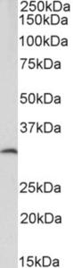 EB12706 (2 µg/ml) staining of Human Adipose lysate (35 µg protein in RIPA buffer). Primary incubation was 1 hour. Detected by chemiluminescence.