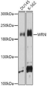 Western blot analysis of extracts of various cell lines, using Anti-Werner's syndrome helicase WRN Antibody (A10013) at 1:1,000 dilution