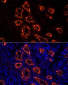 Anti-ACE2 Rabbit Monoclonal Antibody [clone: ARC50948]