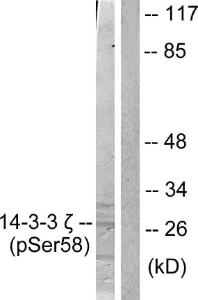 Western blot analysis of lysates from NIH/3T3 cells treated with UV 30' using Anti-14-3-3 zeta (phospho Ser58) Antibody. The right hand lane represents a negative control, where the antibody is blocked by the immunising peptide.