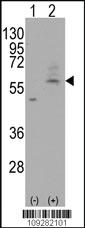 Anti-PMAT(Slc29a4) Rabbit Polyclonal Antibody