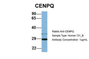 Anti-CENPQ Rabbit Polyclonal Antibody