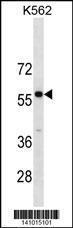 Anti-PBX3 Rabbit Polyclonal Antibody (AP (Alkaline Phosphatase))