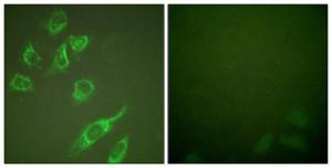 Immunofluorescence analysis of HeLa cells, treated with PMA 125ng/ml 30', using Anti-14-3-3 zeta (phospho Ser58) Antibody. The right hand panel represents a negative control, where the antibody was pre-incubated with the immunising peptide.