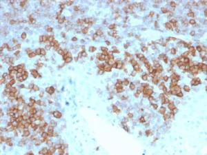 Immunohistochemical analysis of formalin-fixed, paraffin-embedded human tonsil using Anti-CD27 Antibody [LPFS2/4177]