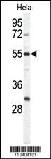 Anti-BMP2 Rabbit Polyclonal Antibody