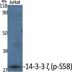 Western blot analysis of various cells using Anti-14-3-3 zeta (phospho Ser58) Antibody