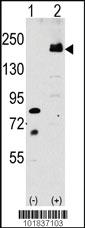 Anti-LRP6 Rabbit Polyclonal Antibody