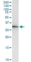 Anti-ZNF215 Rabbit Polyclonal Antibody