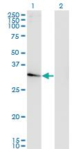 Anti-NACA2 (nascent Polypeptide-associated Complex alpha Subunit 2) Mouse Monoclonal Antibody [clone: 4H6]