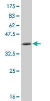 Anti-NFKBIB Mouse Monoclonal Antibody [clone: 2B11]