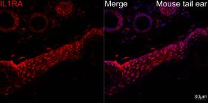 Anti-IL-1RA antibody