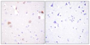 Immunohistochemical analysis of paraffin-embedded human brain tissue using Anti-PLD1 Antibody. The right hand panel represents a negative control, where the antibody was pre-incubated with the immunising peptide.