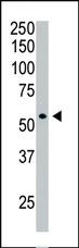 Anti-HDAC1 Rabbit Polyclonal Antibody