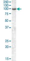 Anti-AGAP2 Goat Polyclonal Antibody