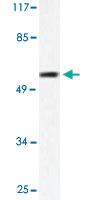 Anti-MMP1 Rabbit Polyclonal Antibody