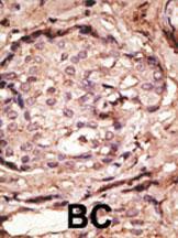 Anti-GFAP Rabbit Polyclonal Antibody (Biotin)