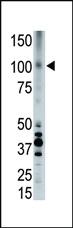 Anti-LRP8 Rabbit Polyclonal Antibody