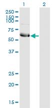 Anti-HSFY1 Mouse Monoclonal Antibody [clone: 1D2]