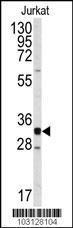 Anti-CDK2 Rabbit Polyclonal Antibody (Biotin)