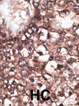 Anti-LRP8 Rabbit Polyclonal Antibody