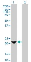 Anti-TAGLN Mouse Monoclonal Antibody [clone: 1E2]