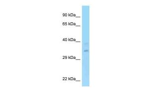 Anti-RPRD1A Rabbit Polyclonal Antibody