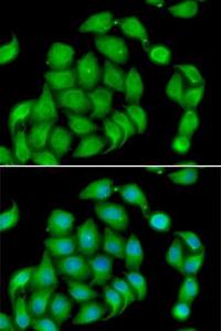 Immunofluorescence analysis of HeLa cells using Anti-Aspartate beta hydroxylase Antibody (A10018). DAPI was used to stain the cell nuclei (blue).