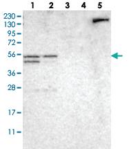 Anti-NDRG3 Rabbit Polyclonal Antibody