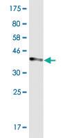 Anti-TRIM36 Mouse Monoclonal Antibody [clone: 1G11]