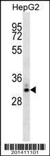 Anti-STC2 Mouse Monoclonal Antibody [clone: 339CT13.2.6]