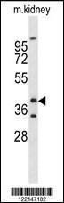 Anti-FOXL1 Rabbit Polyclonal Antibody (AP (Alkaline Phosphatase))