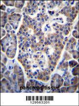 Anti-TP53INP1 Rabbit Polyclonal Antibody (Biotin)