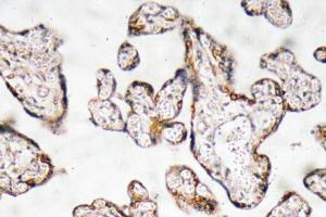 Immunohistochemical analysis of paraffin-embedded human prostate carcinoma tissue using Anti-PEDF Antibody