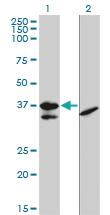 Anti-TCF19 Mouse Monoclonal Antibody [clone: 6D8]