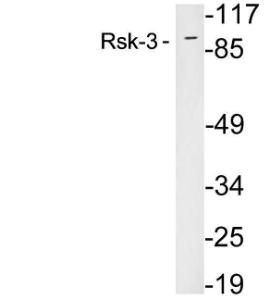 Antibody anti-RSK-3 100 µg