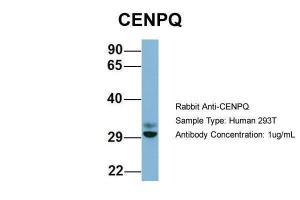 Anti-CENPQ Rabbit Polyclonal Antibody