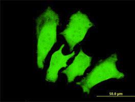 Anti-TNNI3 Mouse Monoclonal Antibody [clone: 1E7]