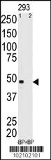 Anti-MAGEA11 Rabbit Polyclonal Antibody