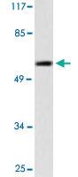 Anti-MMP13 Rabbit Polyclonal Antibody