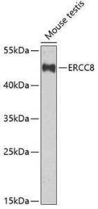 Anti-ERCC8 antibody